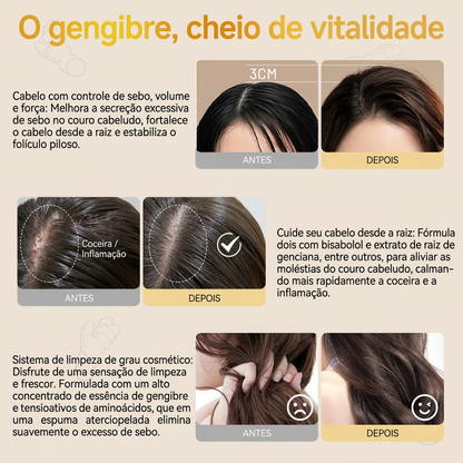 Champú de jengibre QUARXERY para limpieza profunda, equilibrio del control de grasa y crecimiento del cabello